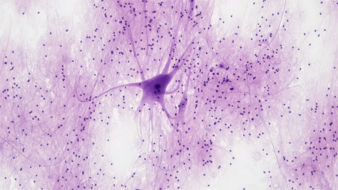 In a controversial study, researchers suggest the stereotypical image of a neuron is wrong